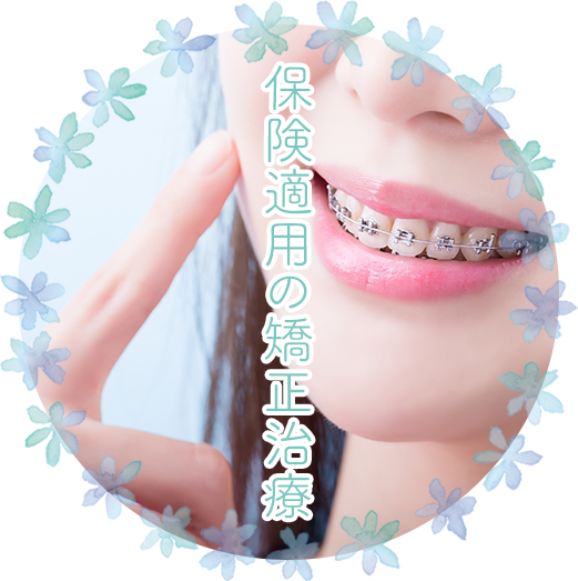 保険適用の矯正治療