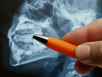 外科的矯正治療