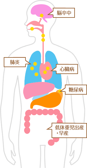 歯周病